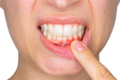Oral Health and Other Health Issues, Is there a Connection? East Van Dentist