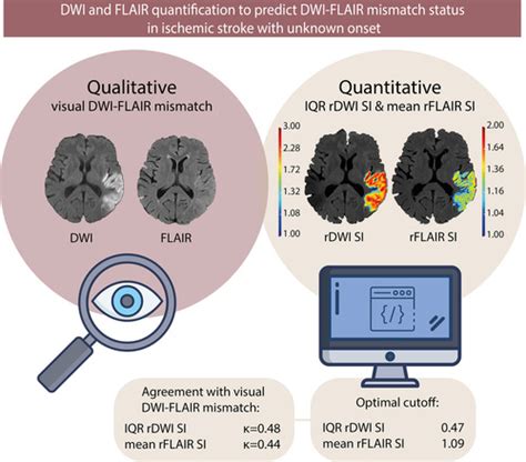 Diffusion-Weighted Imaging and Fluid-Attenuated Inversion Recovery ...