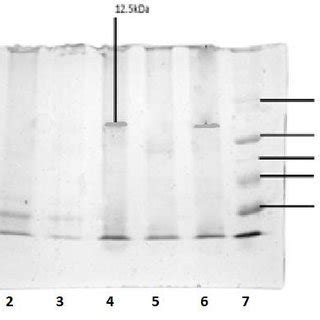 Molecular weight of bacteriocin by tricine-SDS-PAGE Lane -5 bacteriocin... | Download Scientific ...