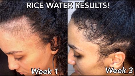 RICE WATER FOR EXTREME HAIR GROWTH RESULTS | BEFORE & AFTER! - YouTube