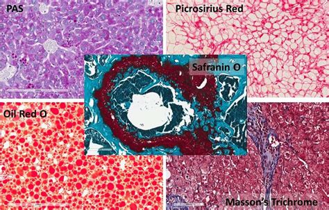 Histology » Molecular Pathology Core » College of Medicine » University of Florida