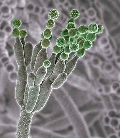 Helminthosporium Sativum Fungi SEM - Bing | Microscopic photography, Fungi, Microbiology