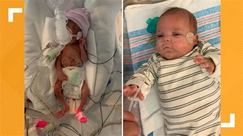 'Miracle baby' born at 22 weeks breaks hospital record | wwltv.com