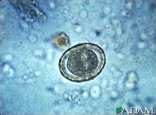 Roundworm eggs - ascariasis: MedlinePlus Medical Encyclopedia Image