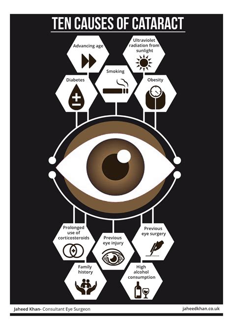 Ten causes of cataracts [Infographic] | Jaheed Khan | London Cataract Surgeon