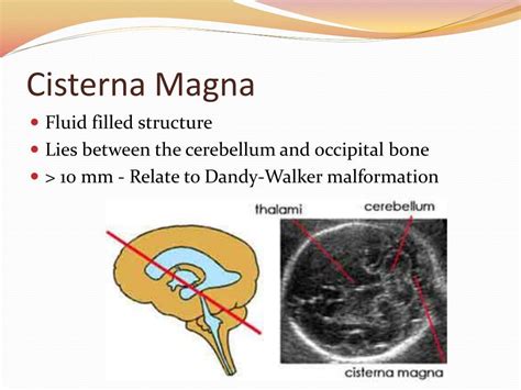 PPT - Obstetrical Measurements 2 nd & 3 rd Trimester PowerPoint ...