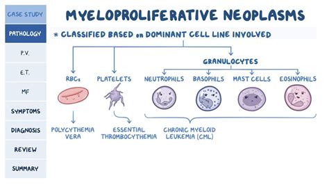 Myeloproliferative disorders: Pathology review: Video | Osmosis