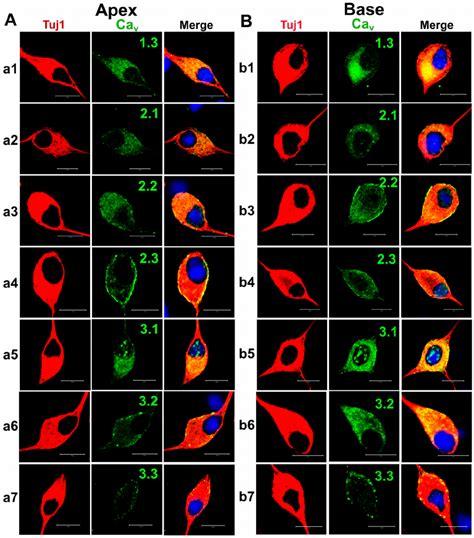 Cultured spiral ganglion neurons express multiple Ca 2+ channels ...