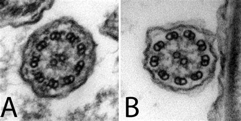 Cilia ultrastructure observed by transmission electron microscopy. (A ...