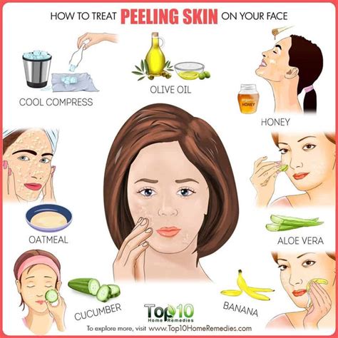 How to Treat Peeling Skin on Face | Top 10 Home Remedies | Peeling skin, Beauty skin care, Skin care