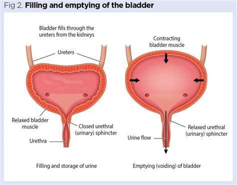 Slow Urine Flow Female Back Pain - IRUCGA