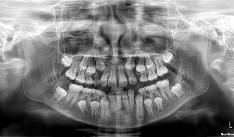 Dental AI Object Detection Dataset by Dental AI