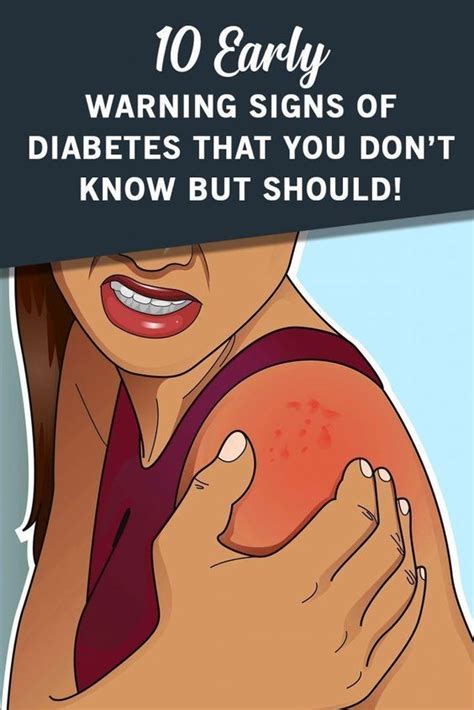 10 Early Warning Signs Of Diabetes Everyone Should Know! - Health Autos