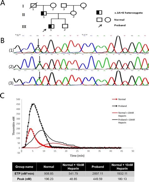 A novel mutation p.Met1Val in SERPINC1 gene causes hereditary antithrombin deficiency in a ...