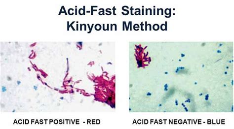 Acid Fast Stain (Kinyoun-Cold Method)- Principle, Procedure and Result ...