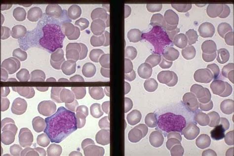 Monocytes And Lymphocytes