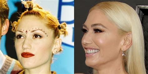 Gwen Stefani Plastic Surgery Facelift Nose Job Before After | Hot Sex Picture