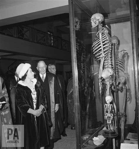 Why a London museum should return the stolen bones of an Irish giant