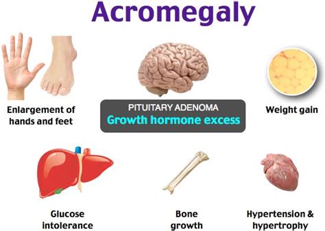 Rosh Review | Endocrine system nursing, Nursing mnemonics, Endocrine disorders