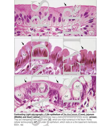 Jejunum Vs Ileum Histology