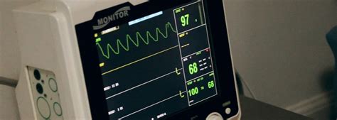 7 Signs of AFib and Arrhythmia That You Don’t Want to Miss | UPOlife