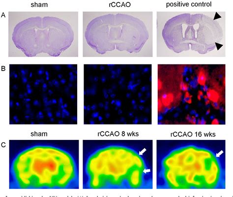 Figure 1 from Chronic cerebral hypoperfusion in a mouse model of ...