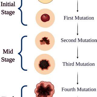 Blood Cancer Types