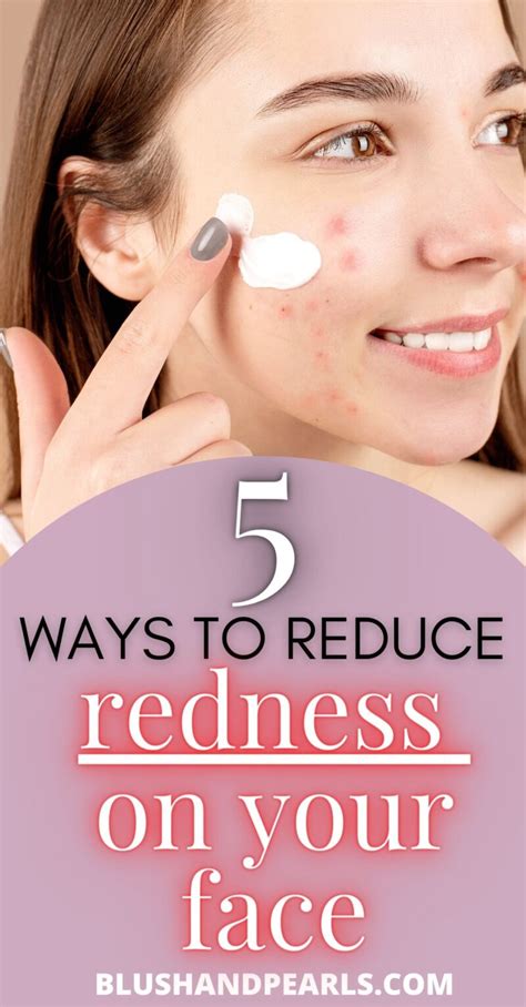 5 Ways To Manage Facial Redness Blush & Pearls