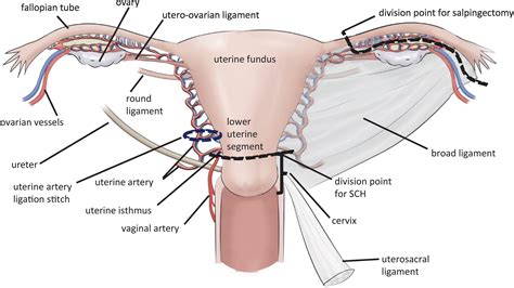 Cardinal Ligament Ureter