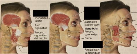 Músculos de la masticación Diagram | Quizlet