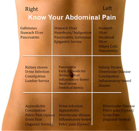 Life Style: Know Your Abdominal Pain