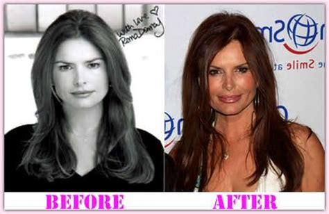 Roma Downey Plastic Surgery – A Younger looking appearance. | Plastic surgery, Roma downey, Surgery