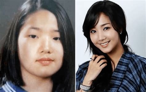 Korean Stars Plastic Surgery