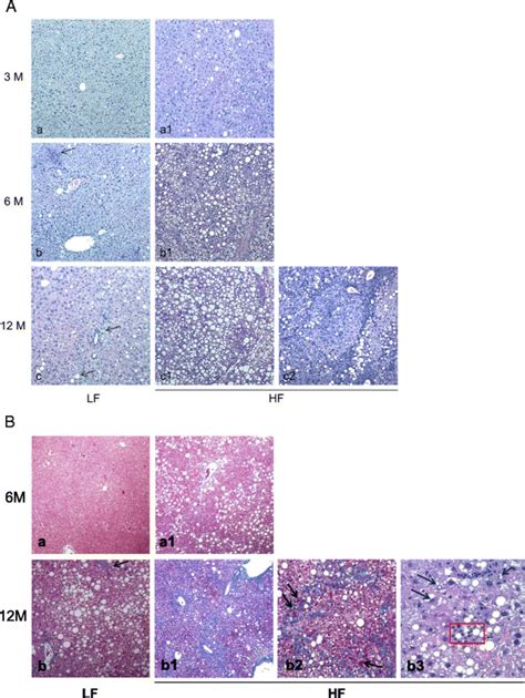 Histopathological features of hepatic tissues. A Histopathological... | Download Scientific Diagram