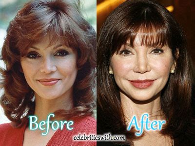 Victoria Principal Plastic Surgery: Facelift, Botox, Boob Job, Before ...