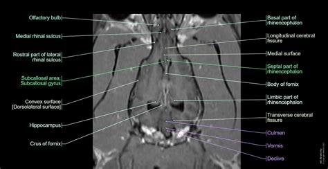 Canine Brain MRI Atlas - Veterinary Radiology: normal anatomy | vet-Anatomy