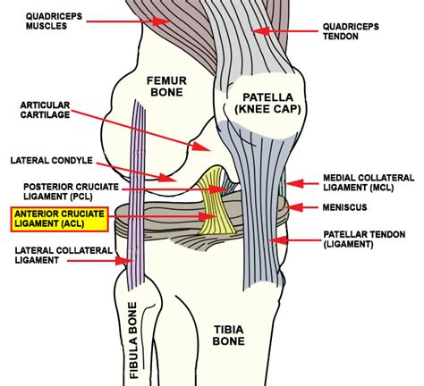 Anterior Cruciate Ligament (ACL) Injuries - Advanced Orthopedic & Sports Medicine Specialists