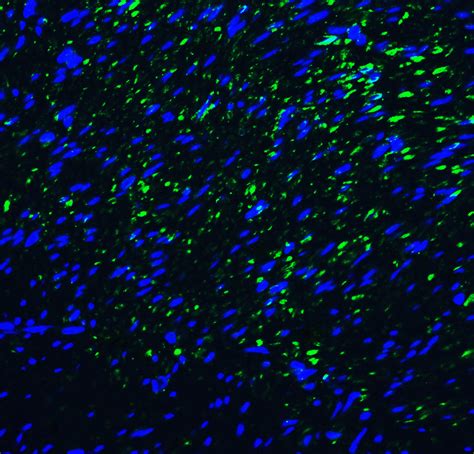 TIM-3 Antibody - Cat. No. RF16108 | ProSci