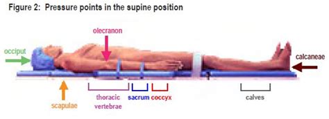 Supine Position: Definition, Explanation, Pros, and Cons