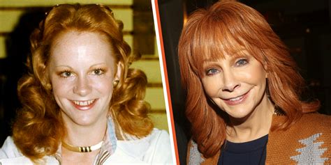 Has Reba McEntire Had Plastic Surgery? A Specialist in the Field Weighs In