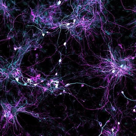 Researchers learn how to grow old brain cells using stem cell technology