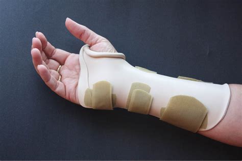 Thermoplastic Splints | Hand Network