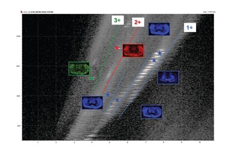 Mass Spectrometry Imaging | DESI and MALDI | Waters