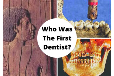 Interesting Facts About The History Of Dentistry » Top Cosmetic Dentist ...