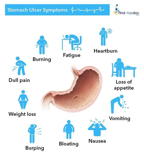 Stomach Ulcer: Causes, Diagnosis, and Treatment | FindATopDoc