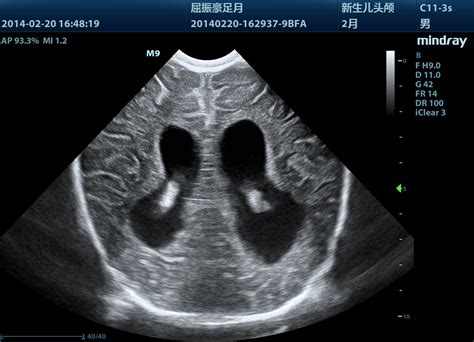 Mindray M9 – The Ultrasound Source