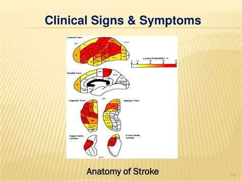 PPT - acute stroke PowerPoint Presentation, free download - ID:2361188