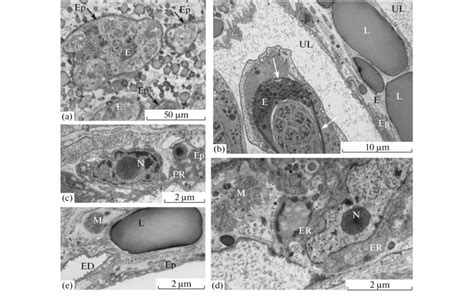 Fine structure of the uterus in Arostrilepis tenuicirrosa (transmission... | Download Scientific ...