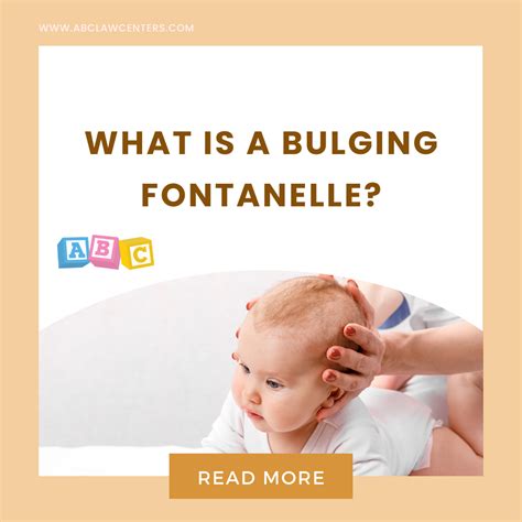 Bulging Fontanelle: A Sign of Birth Injury?