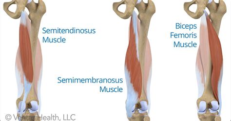 Proximal Hamstring Tendinopathy A Common Cause Of Butt Pain In ...